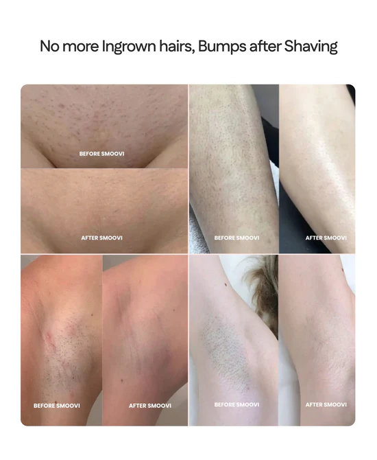 Female Bikini - Dual Head Shaver