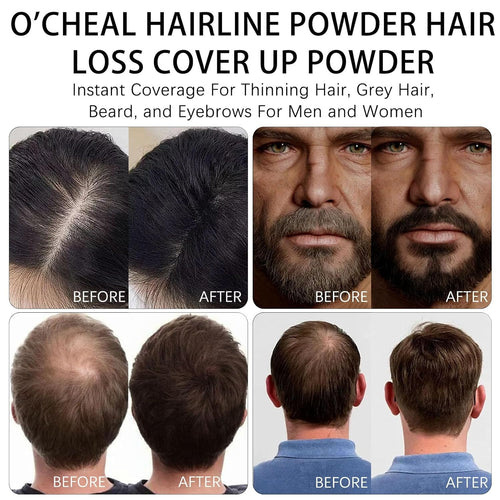 Ocheal - Hairline Powder Full Hair Coverage
